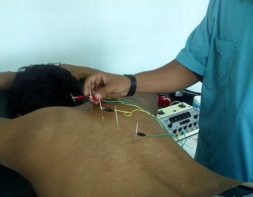 La osteocondrosis y las hernias de la columna vertebral del ejercicio