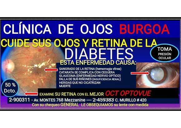 CLINICA DE OJOS BURGOA 0