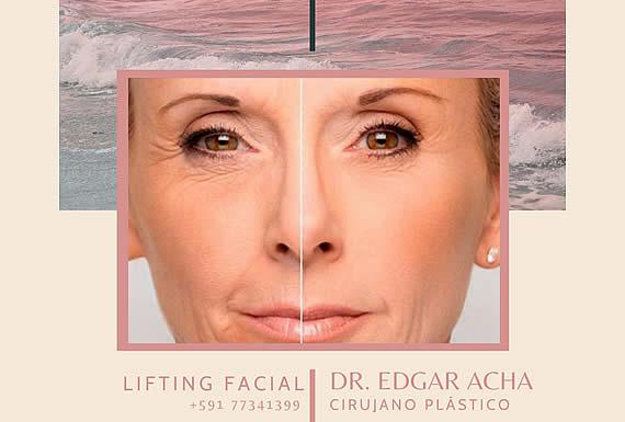 DR. EDGAR ACHÁ VARGAS 0