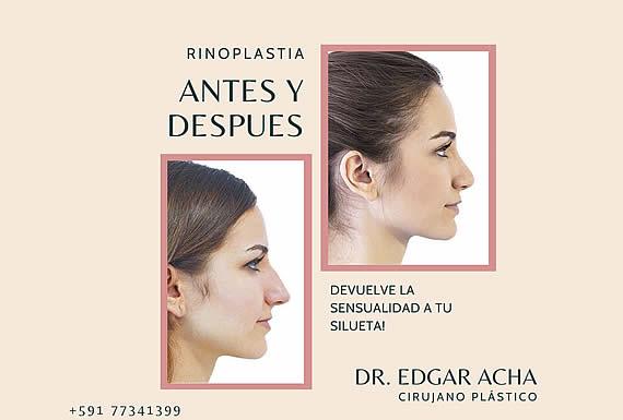 DR. EDGAR ACHÁ VARGAS 2