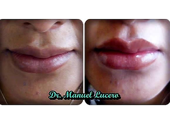 DR. MANUEL LUCERO CARRIÓN 2