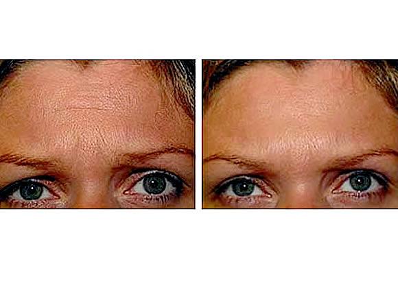 DR. MANUEL LUCERO CARRIÓN 3