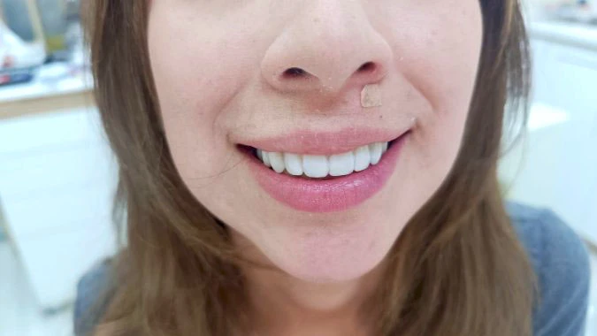 Diseño de sonrisa Diseño de sonrisa
