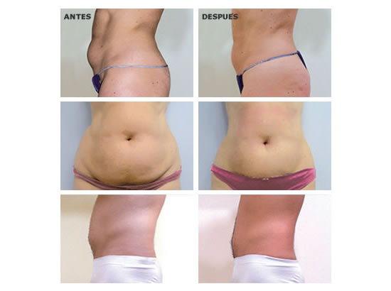 FIOSIOTERAPIA Y ESTETICA “FIOSIOMESTIC” 4