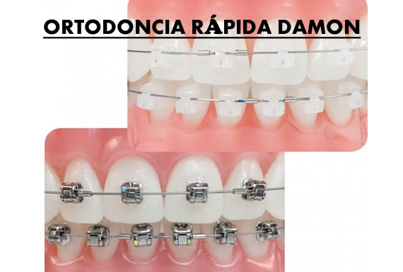 CENTRO DE ESPECIALIDADES ODONTOLOGICAS  “HAPPY SMILE” 1