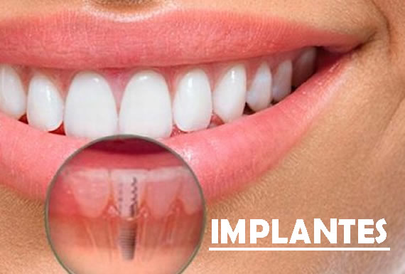 CENTRO DE ESPECIALIDADES ODONTOLOGICAS  “HAPPY SMILE” 2