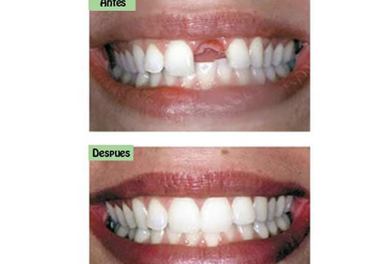 CENTRO DE ESPECIALIDADES ODONTOLOGICAS  “HAPPY SMILE” 3