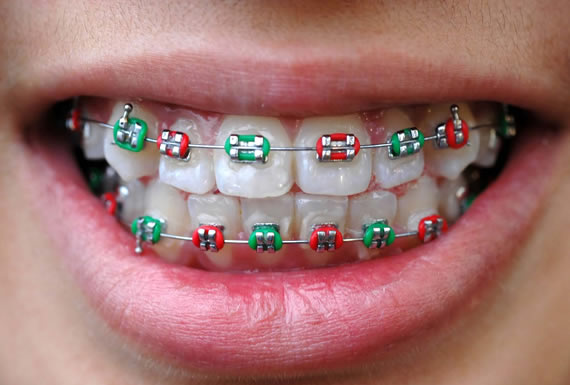 CENTRO DE ESPECIALIDADES ODONTOLOGICAS  “HAPPY SMILE” CENTRO DE ESPECIALIDADES ODONTOLOGICAS  “HAPPY SMILE”