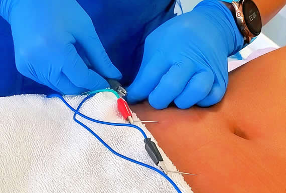 Fisioterapia Dermatofuncional Fisioterapia Dermatofuncional