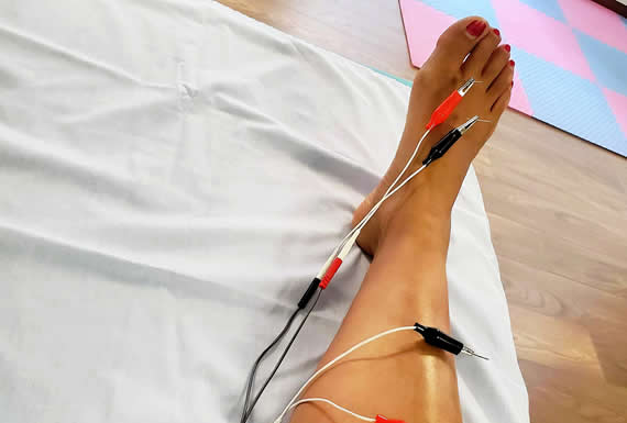 Fisioterapia Invasiva Fisioterapia Invasiva