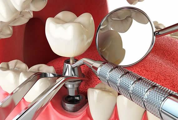 ODONTO ESTHETIC- CAMBIANDO VIDAS CREANDO SONRISAS 1