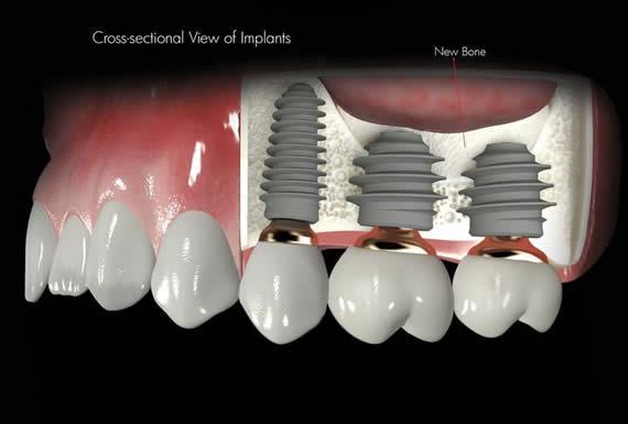 ODONTO ESTHETIC- CAMBIANDO VIDAS CREANDO SONRISAS 2
