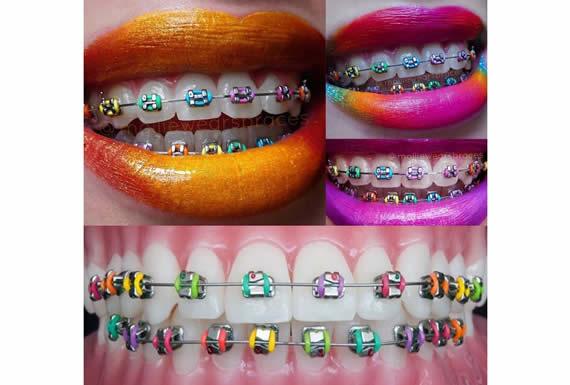 ODONTO ESTHETIC- CAMBIANDO VIDAS CREANDO SONRISAS 3