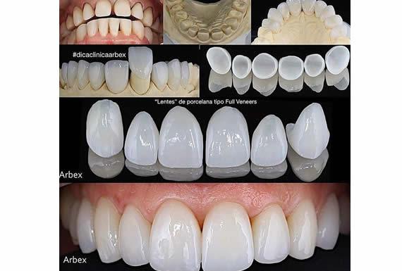 ODONTO ESTHETIC- CAMBIANDO VIDAS CREANDO SONRISAS 4
