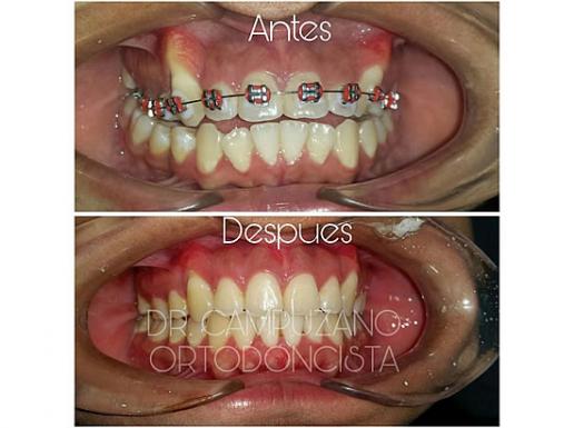 ORTODONCIA ESPECIALIZADA 1