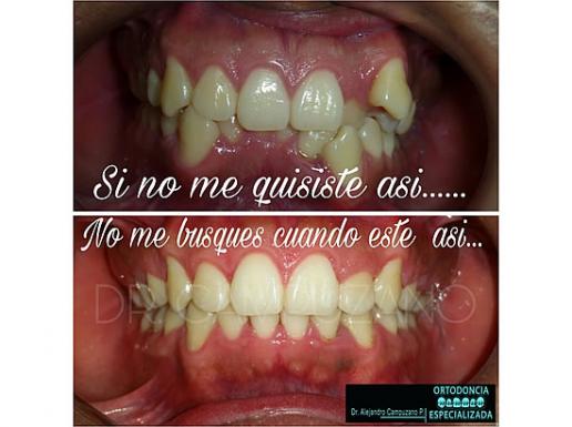 ORTODONCIA ESPECIALIZADA 2