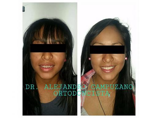 ORTODONCIA ESPECIALIZADA 3