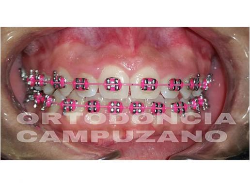 ORTODONCIA ESPECIALIZADA 4