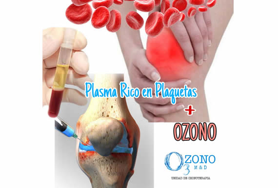 OZONO M&D – UNIDAD DE OZONOTERAPIA 2