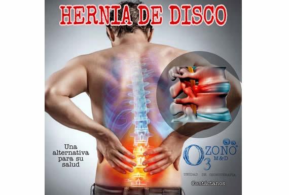 OZONO M&D – UNIDAD DE OZONOTERAPIA