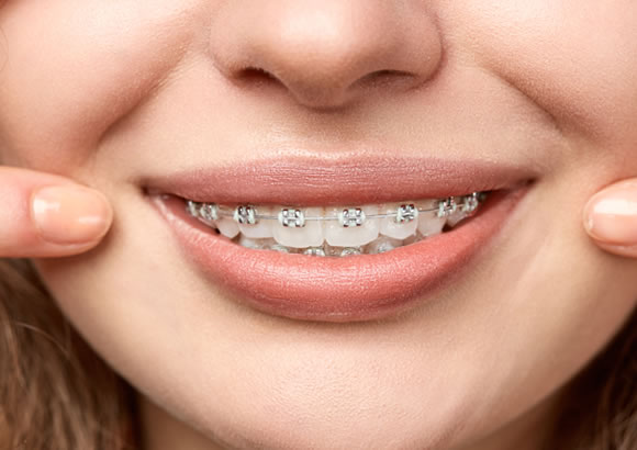 CONSULTORIO DENTAL ROXANA CALIZAYA 0