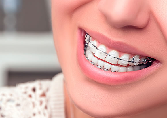 CONSULTORIO DENTAL ROXANA CALIZAYA 1