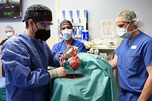 Médicos estadounidenses implantan por primera vez un corazón de cerdo a un humano 