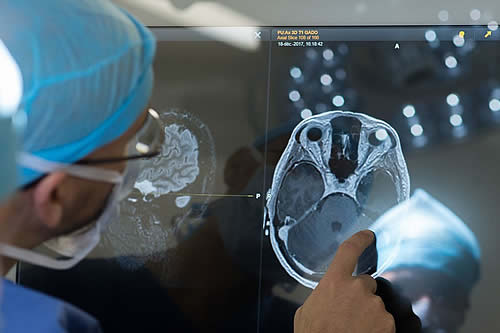 Escanear el cerebro con más fuerza magnética mejora el tratamiento del párkinson 