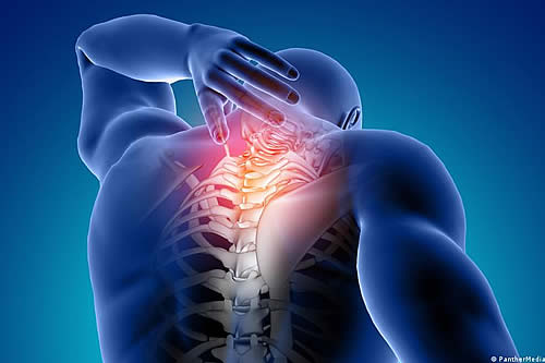 ¿Cuál es la mejor manera de tratar el dolor de espalda? Nuevo estudio ofrece guía útil de medicación 