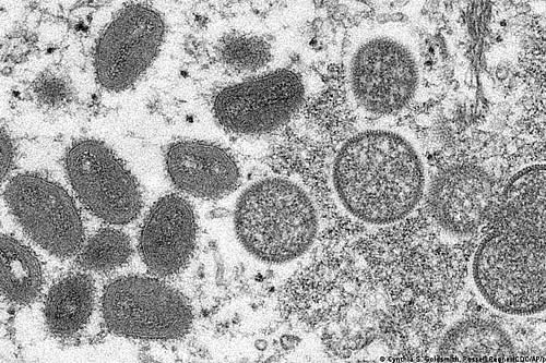 Viruela del mono: ECDC sugiere vacunar a contactos de riesgo de infectados 